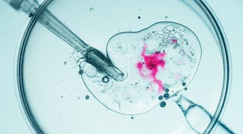 Thumbnail of IVF Assessment