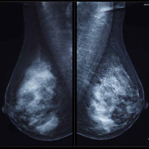 Pathological Examination 