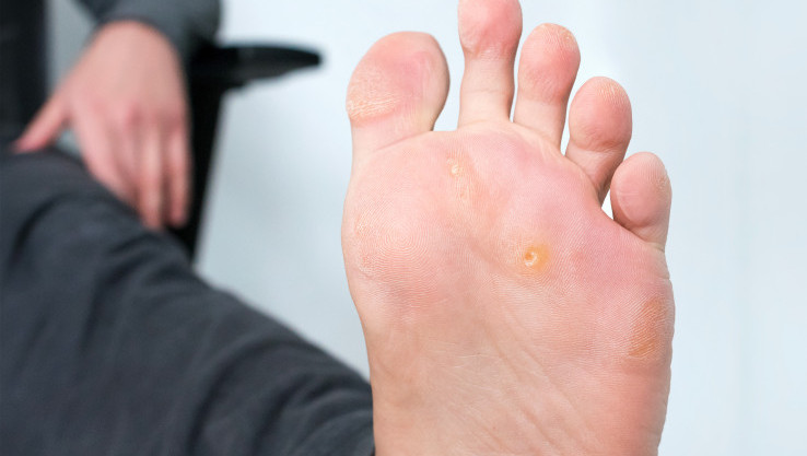 Thumbnail of