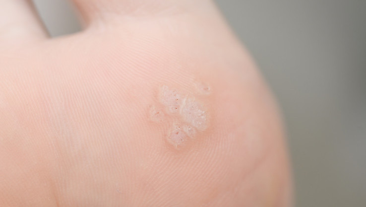 Thumbnail of