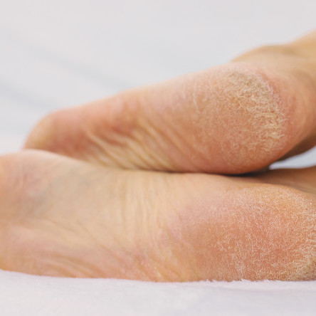 Thumbnail of Cancer Treatment