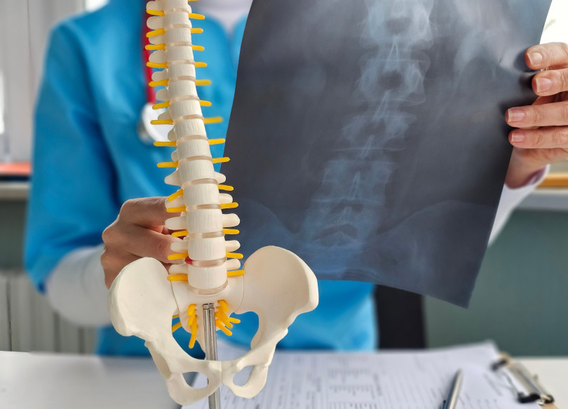 Degenerative Spine Disease