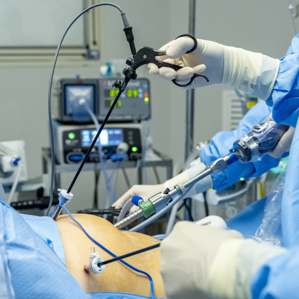 Minimally Invasive Gynaecology