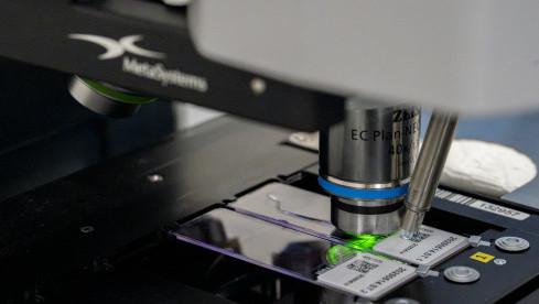 Thumbnail of Single Gene Disorder Screening