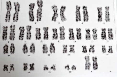 Thumbnail of Screening for Down Syndrome