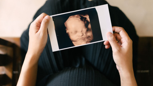 Thumbnail of 3D/4D Ultrasound