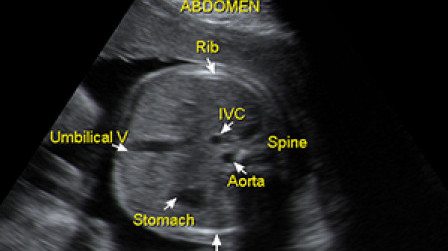 Cross-sectional view of the fetal abdomen