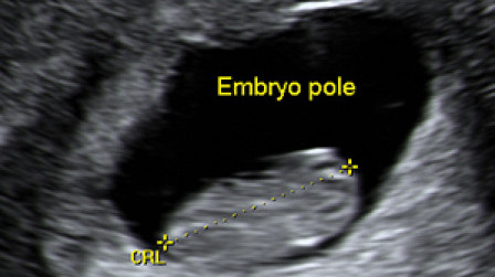 The crown-rump length of the embryo at 9 weeks