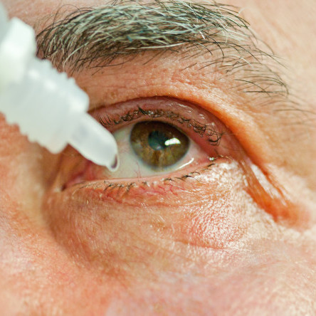 Thumbnail of Topical Anaesthesia