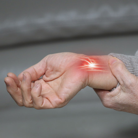 Thumbnail of Carpal Tunnel Syndrome