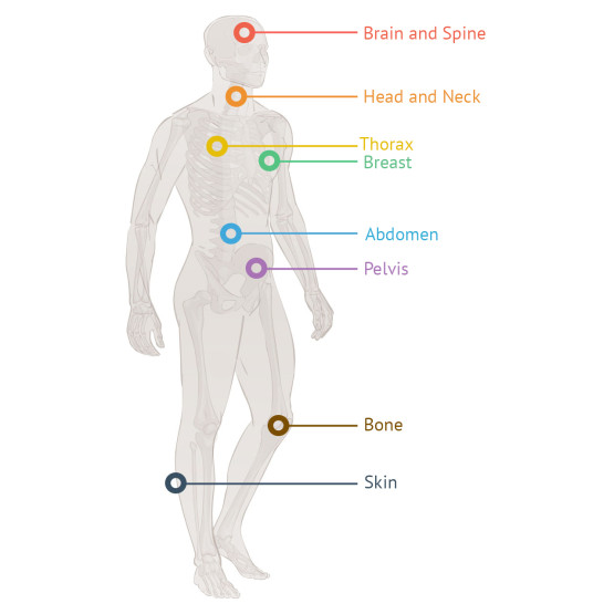 Thumbnail of Cancer Sites