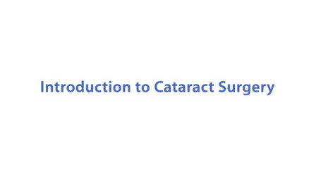 Introduction to Cataract Surgery