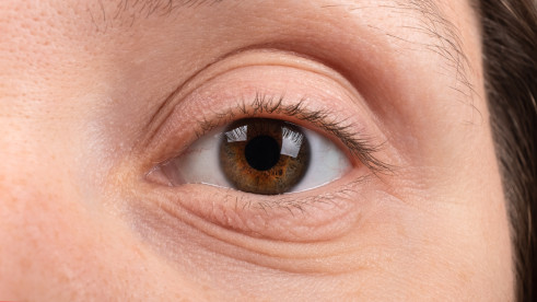 Thumbnail of Corneal Transplantation