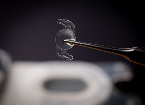 Thumbnail of Lens Exchange