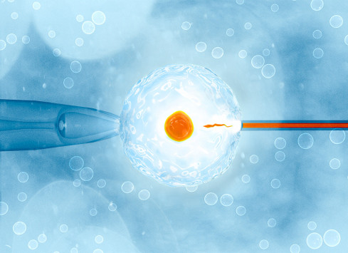 Thumbnail of Assisted Reproductive Health
