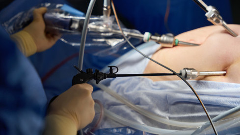 Thumbnail of Weight Management and Metabolic Surgery