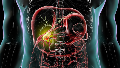 Thumbnail of  Hepatobiliary & Pancreatic Surgery