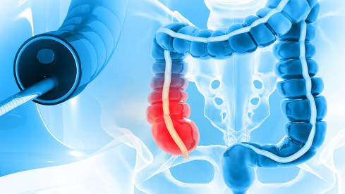 Thumbnail of Colorectal Surgery