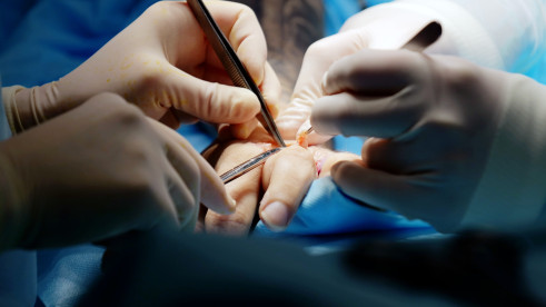 Thumbnail of Hand, Upper Limb and Microsurgery