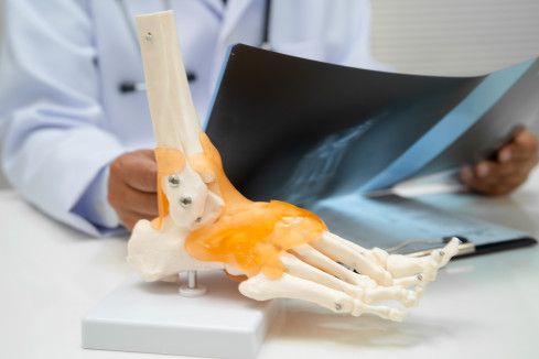 Thumbnail of Foot & Ankle Problems