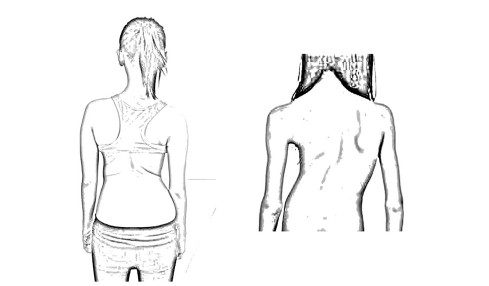 Thumbnail of Deformities
