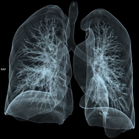 Thumbnail of Pulmonary Surgery