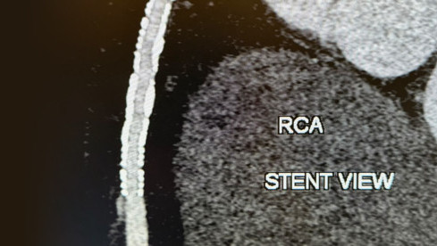 Thumbnail of Advanced Imaging Examinations