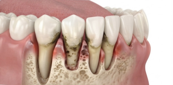Thumbnail of Periodontic Dentistry