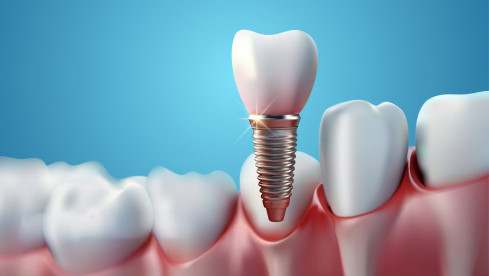Thumbnail of Oral Maxillofacial Surgery