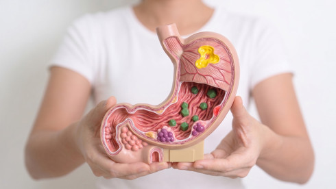 Thumbnail of Stomach