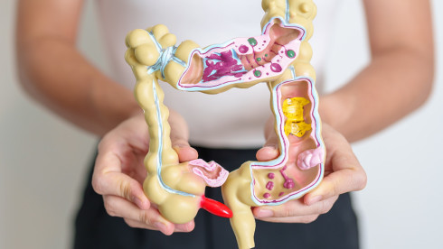 Thumbnail of Bowel