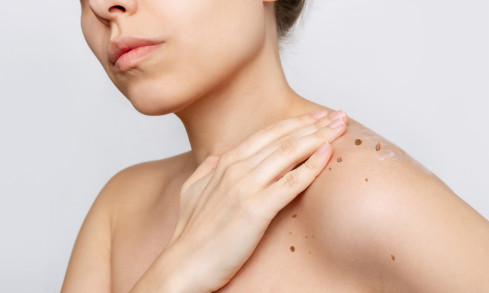Thumbnail of Skin Tumour And Skin Cancer Surgery