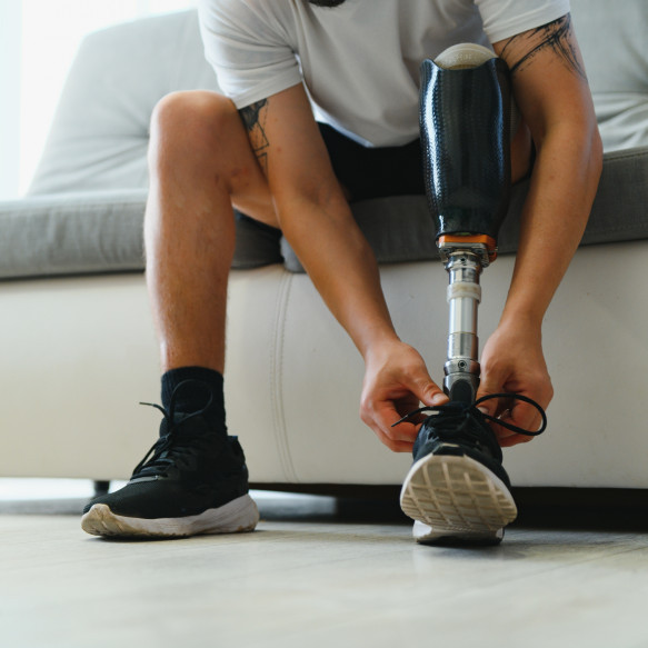 Prosthetic service