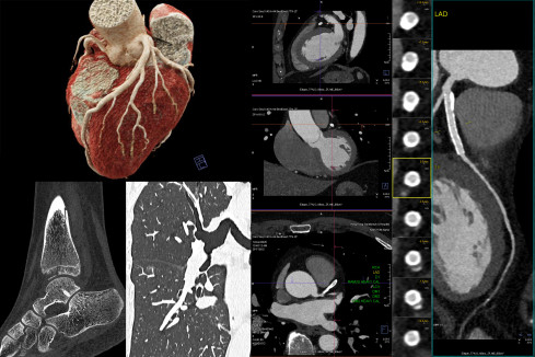 Thumbnail of Computed Tomography