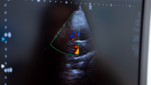 Thumbnail of Ultrasound Examination