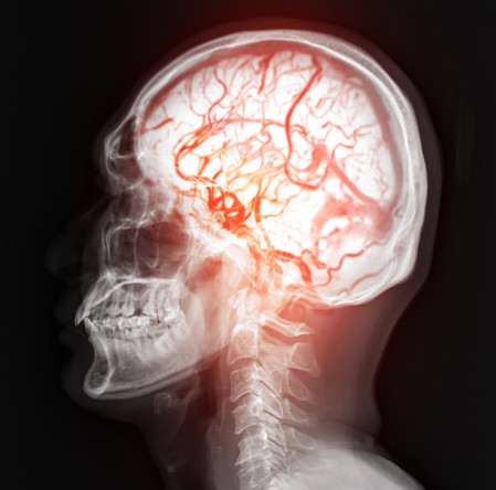 Thumbnail of What is Clinical Neuroscience?